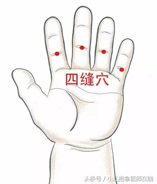 6,小宝宝吃饭不好,可以掐四缝穴.